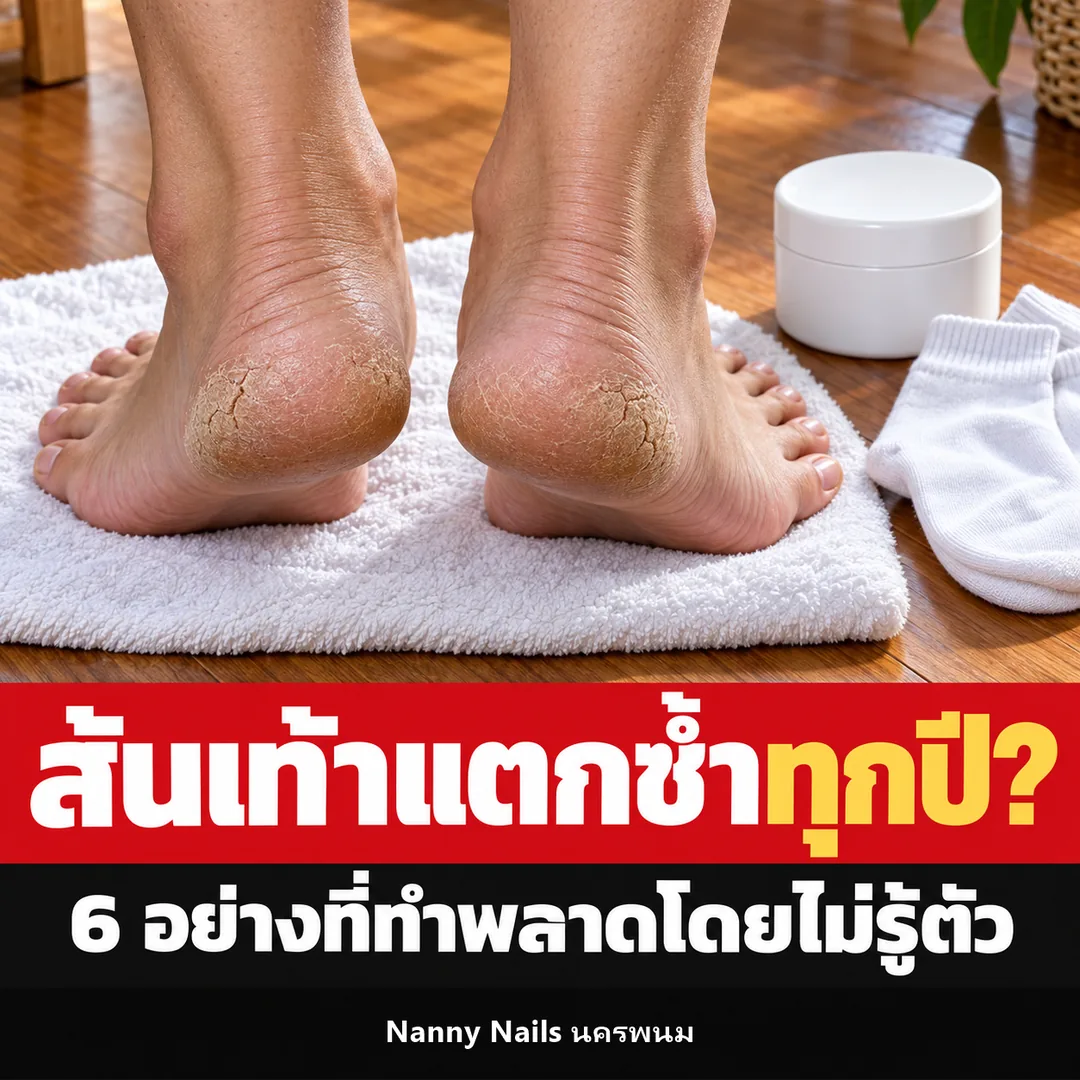 ปกบทความ ส้นเท้าแตกเกิดจากอะไร 6 สิ่งที่ทำพลาดจนส้นแตกซ้ำทุกปี Nanny Nails นครพนม