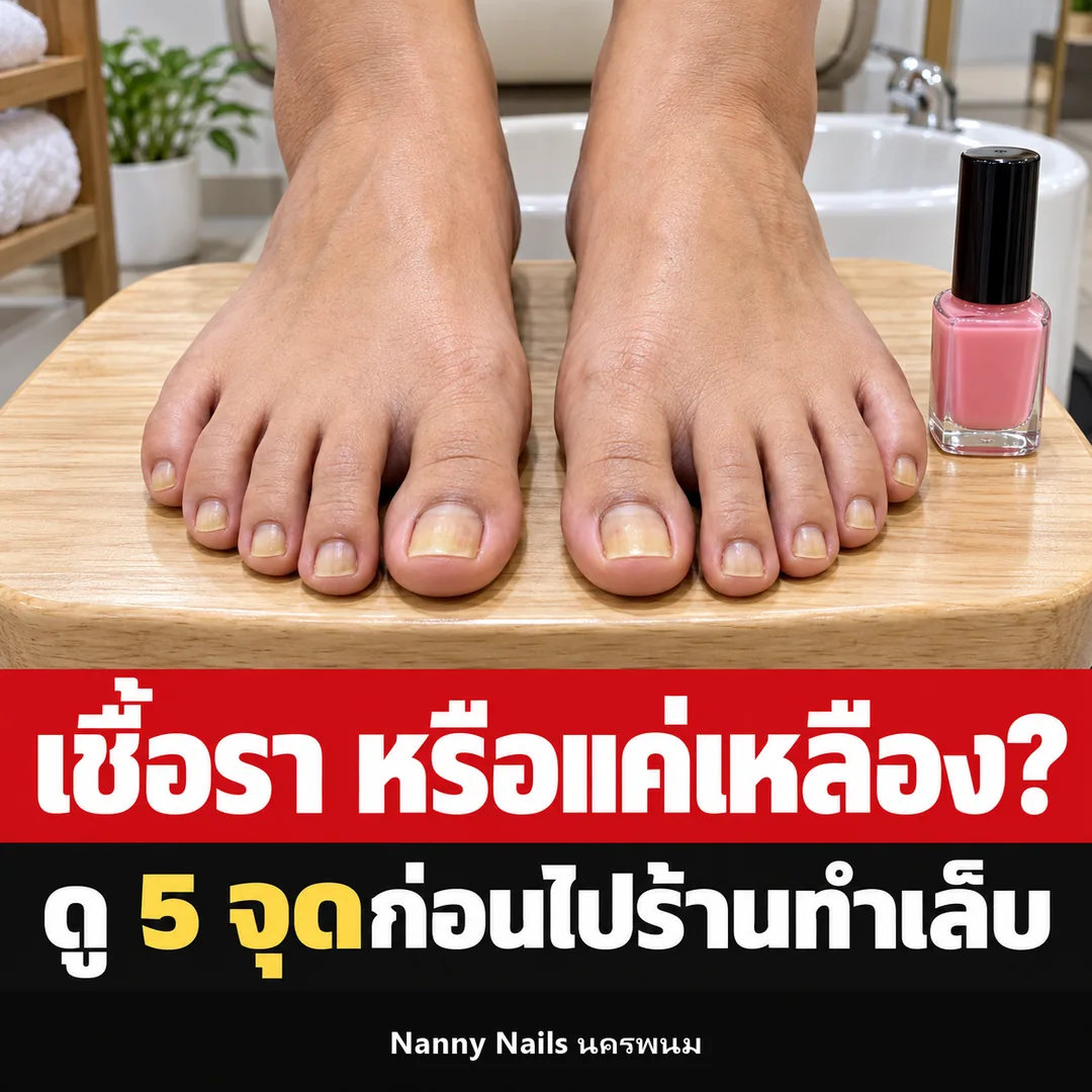 ปกบทความ เชื้อราที่เล็บ หรือแค่เล็บเหลือง ดู 5 จุดก่อนไปร้านทำเล็บ Nanny Nails นครพนม