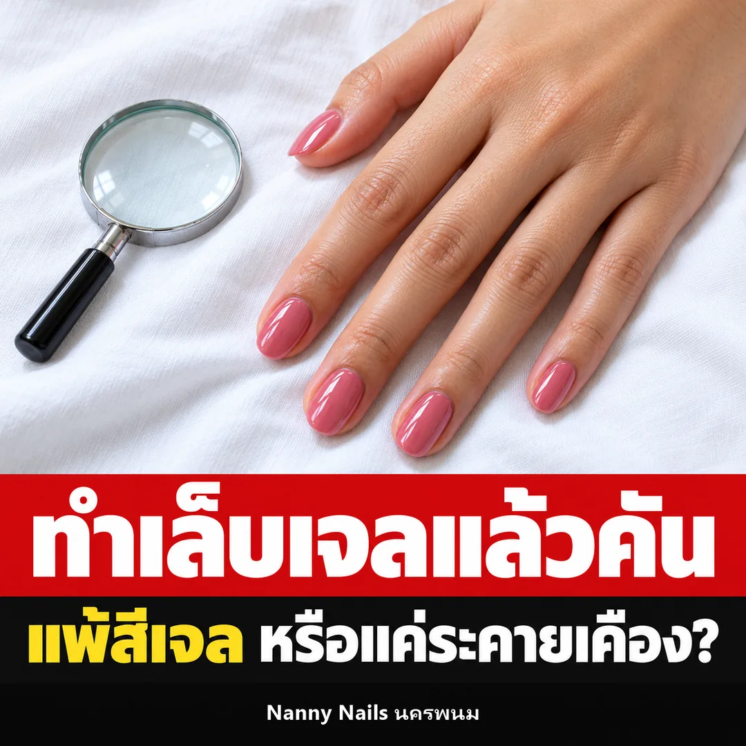 ปกบทความ ทำเล็บเจลแล้วคัน แพ้สีเจลหรือแค่ระคายเคือง Nanny Nails นครพนม