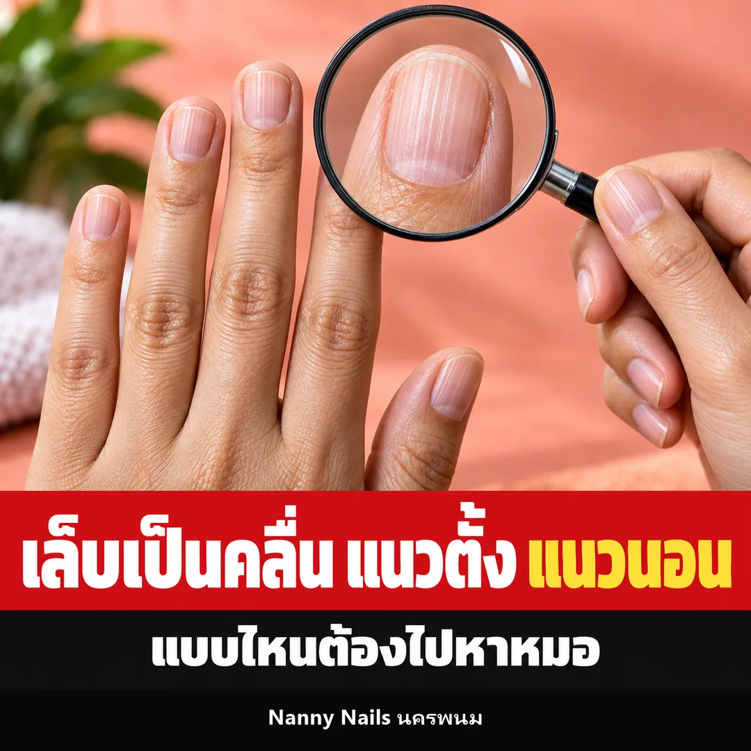 ปกบทความ เล็บเป็นคลื่นแนวตั้ง แนวนอน แบบไหนต้องไปหาหมอ Nanny Nails นครพนม