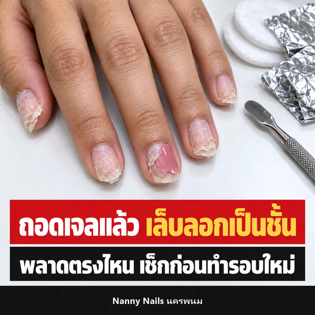 ปกบทความ ถอดเจลแล้วเล็บลอกเป็นชั้น พลาดตรงไหน Nanny Nails นครพนม