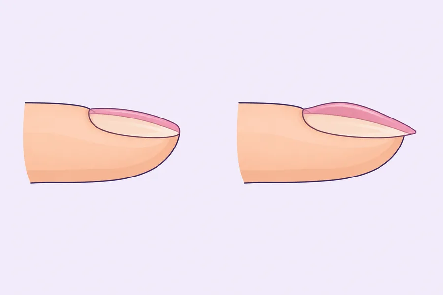 Illustration comparing a thin, even rubber base layer with a thicker builder gel layer with an apex on a natural nail, Nanny Nails, Nakhon Phanom